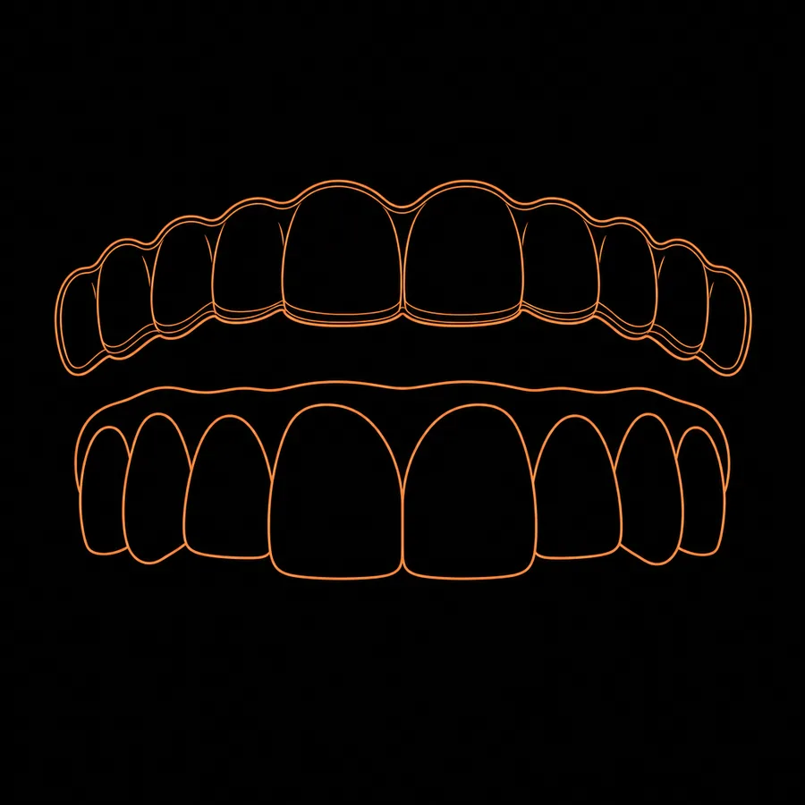 Dibujo esquemático: una férula alineadora transparente flota sobre una hilera de dientes frontales, justo antes de colocarse