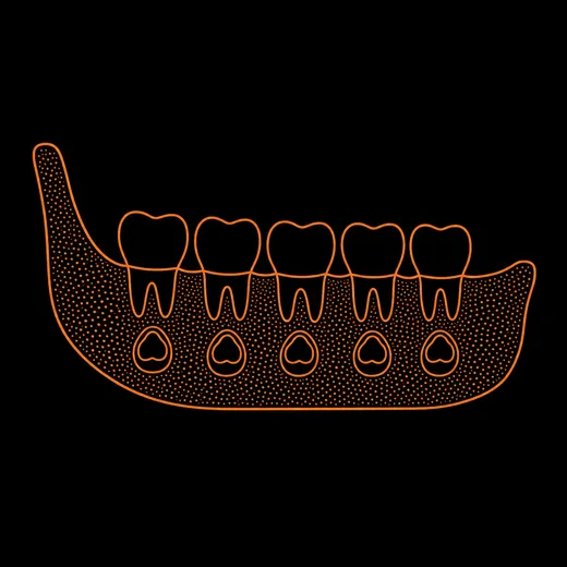 Esquema: mandíbula infantil vista de lado – cinco dientes de leche y, debajo, los gérmenes de los dientes permanentes