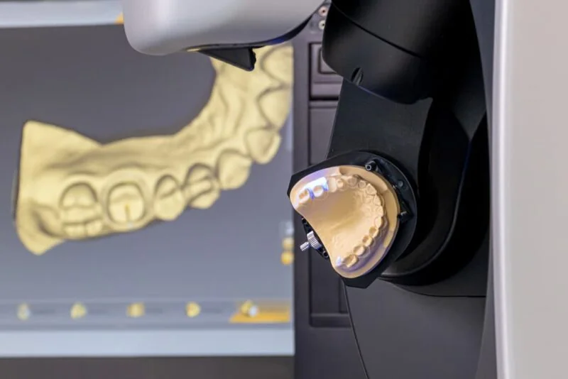 CAD/CAM-Fräse bei der Arbeit am Zahnersatz